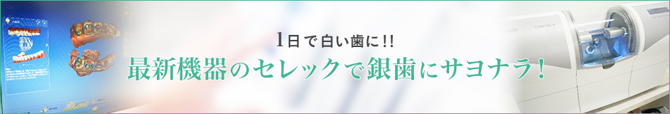 最新機器のセレックで銀歯にサヨナラ！